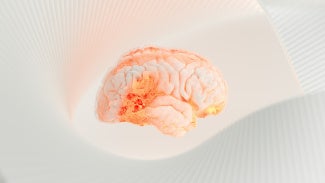 Brain with technology resembling artificial intelligence